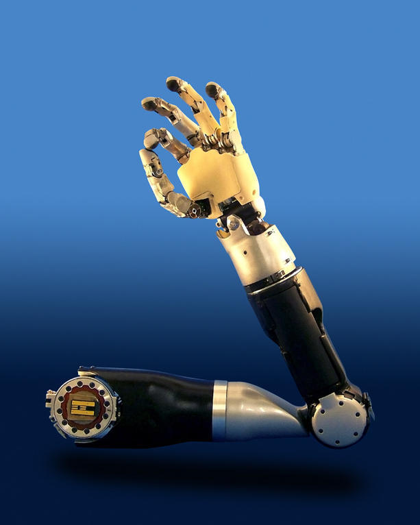 New technology advances prosthetic arm